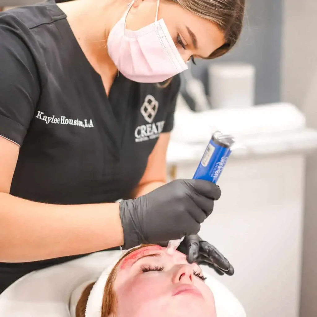 Microneedling in Knoxville TN