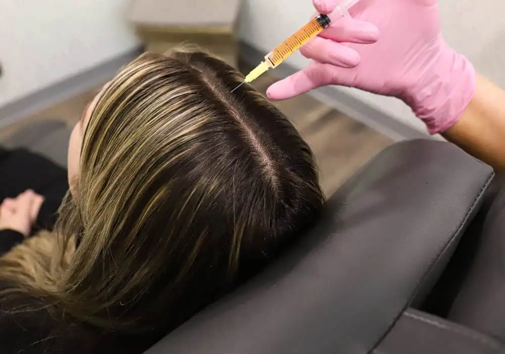 PRP© Hair Restoration in Knoxville TN