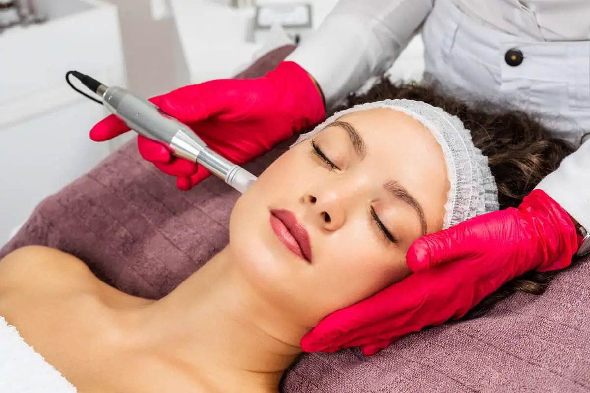 Microneedling in knoxville TN by Create Medical Aesthetics