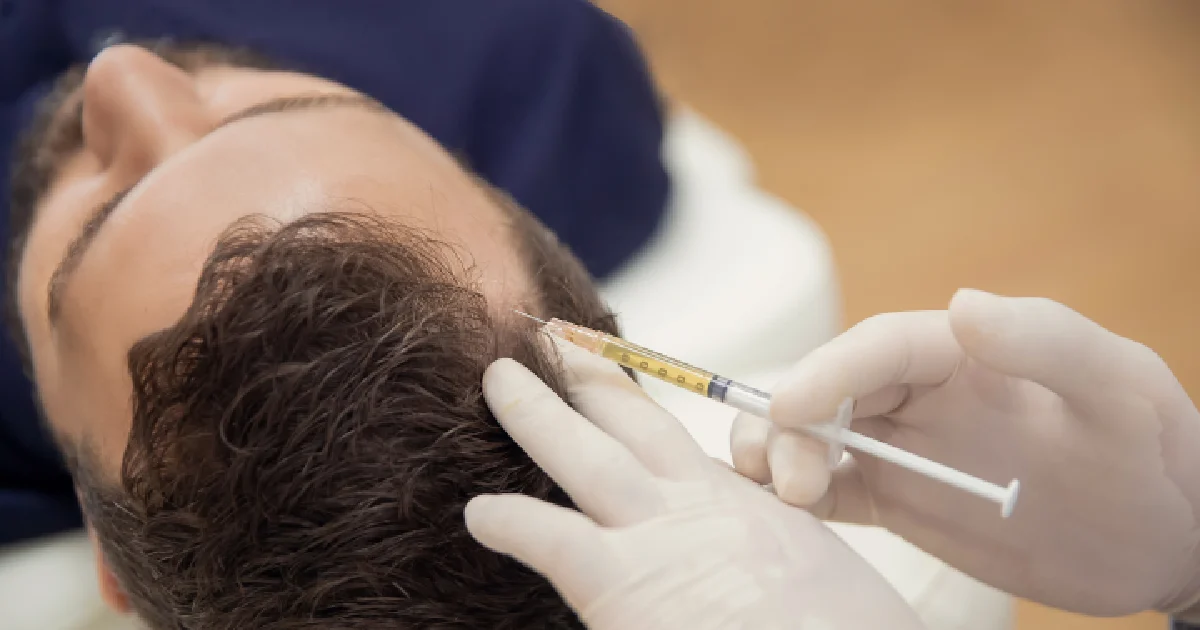 Man receiving Hair restoration treatment in Knoxville, TN